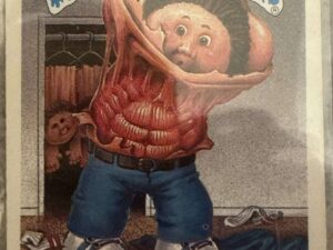 1987 Excellent Topps Garbage Pail Kids #346b Skin Les Ungraded